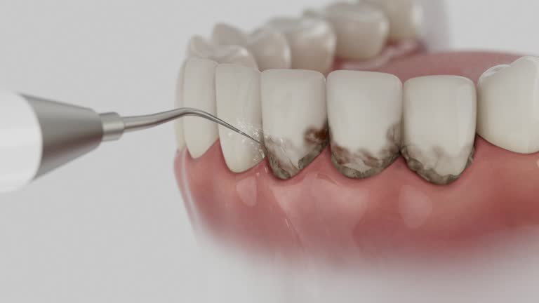 Reliable Root Canal Treatment contractor in Barnes County County, ND by Dentist Open Now